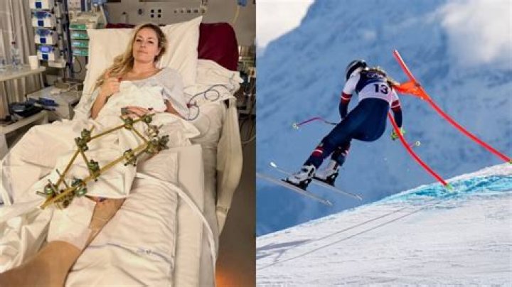
Is Marin Hamill Related To Mark Hamill? Olympics Crash And Injury Details – How Did She Fall? 